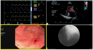 CaptureITPro Software